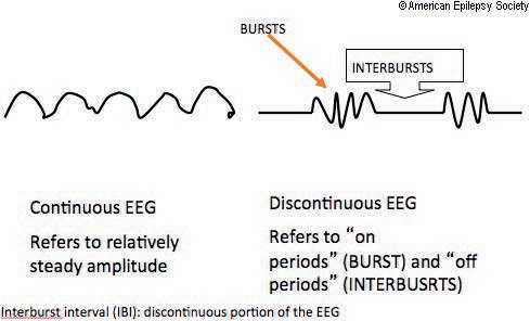 Continuity of the neonatal EEG. Continuity in neonatal EEG refers to a trace with relatively steady amplitude